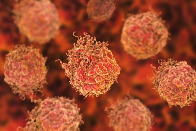 Cat traiesti cu cancer de prostata