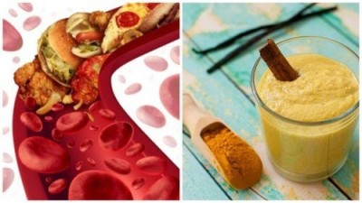 Cele mai bune remedii naturiste pentru a preveni depunerea grăsimilor pe artere!