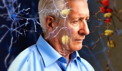 Cele mai bune remedii naturiste pentru a ține boala Alzheimer la distanță