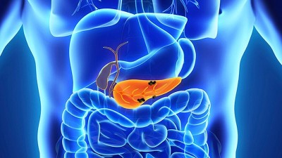 Cum recunoști cancerul pancreatic - simptomele pe care nu trebuie să le ignori