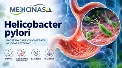 Helicobacter pylori – bacterie spiralată la nivelul mucoasei stomacului