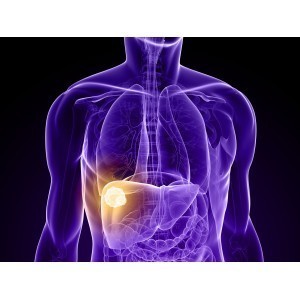 Hepatita A