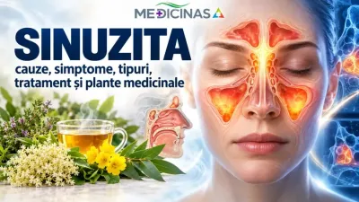 Sinusurile paranazale – anatomie și localizarea sinuzitei