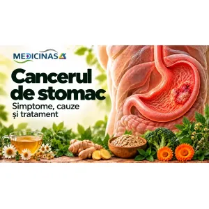 Cancerul de stomac – reprezentare medicală a unei tumori gastrice și a mucoasei stomacului