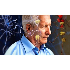 Cele mai bune remedii naturiste pentru a ține boala Alzheimer la distanță