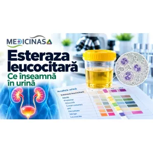 Esteraza leucocitară – test urinar pentru detectarea indirectă a leucocitelor