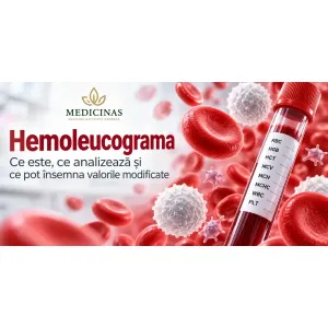 Hemoleucograma, analiza sângelui