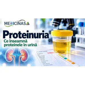 Proteinuria – prezența proteinelor în urină și analiza pentru evaluarea rinichilor