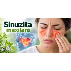 Sinuzita maxilară – inflamația sinusurilor maxilare situate sub ochi